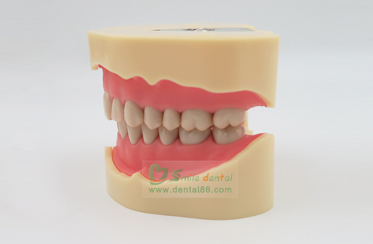 TM-A5-01 Standard Model, BF Style